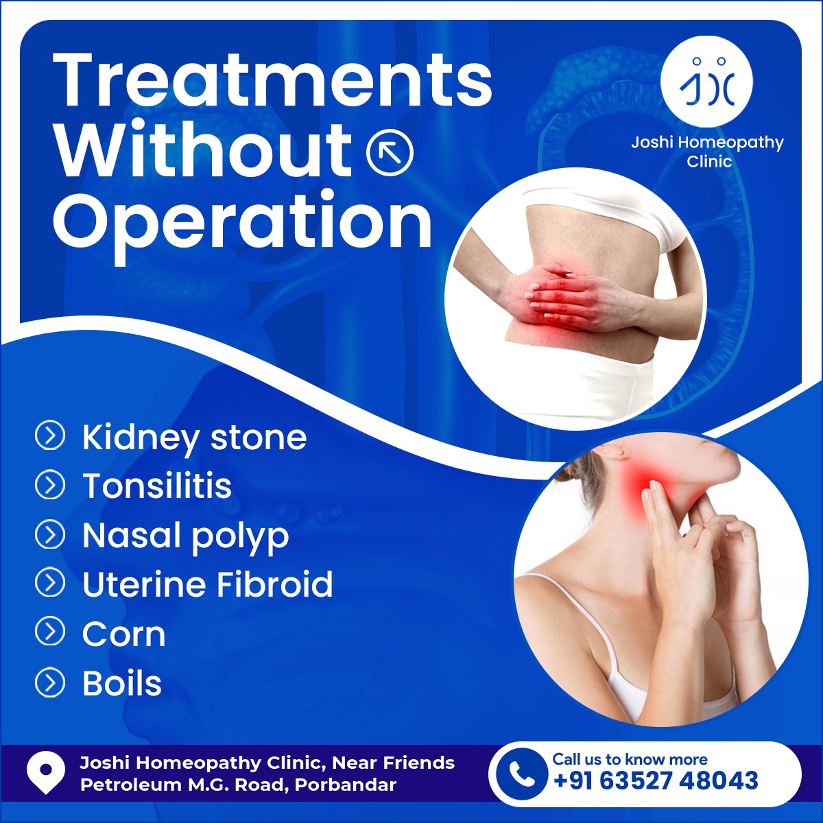 Non-Surgical Treatment